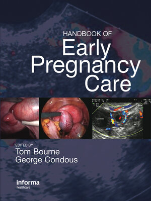cover image of Handbook of Early Pregnancy Care